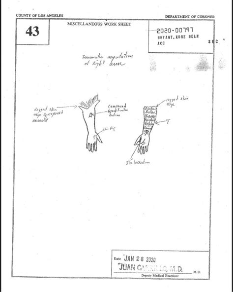 gigi kobe autopsy|Autopsyfiles.org